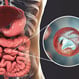 What Are the Symptoms of Cryptosporidiosis?